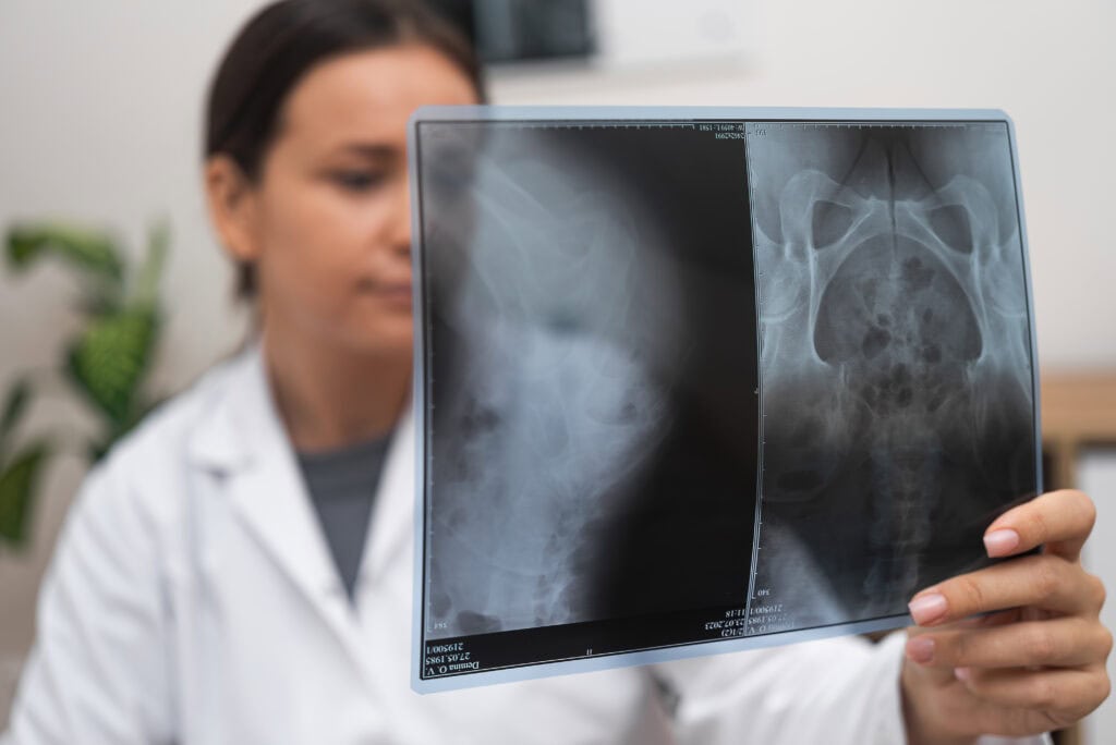 doctor viewing x-ray